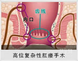 厦门肛肠医院-厦门新开元医院肛肠科